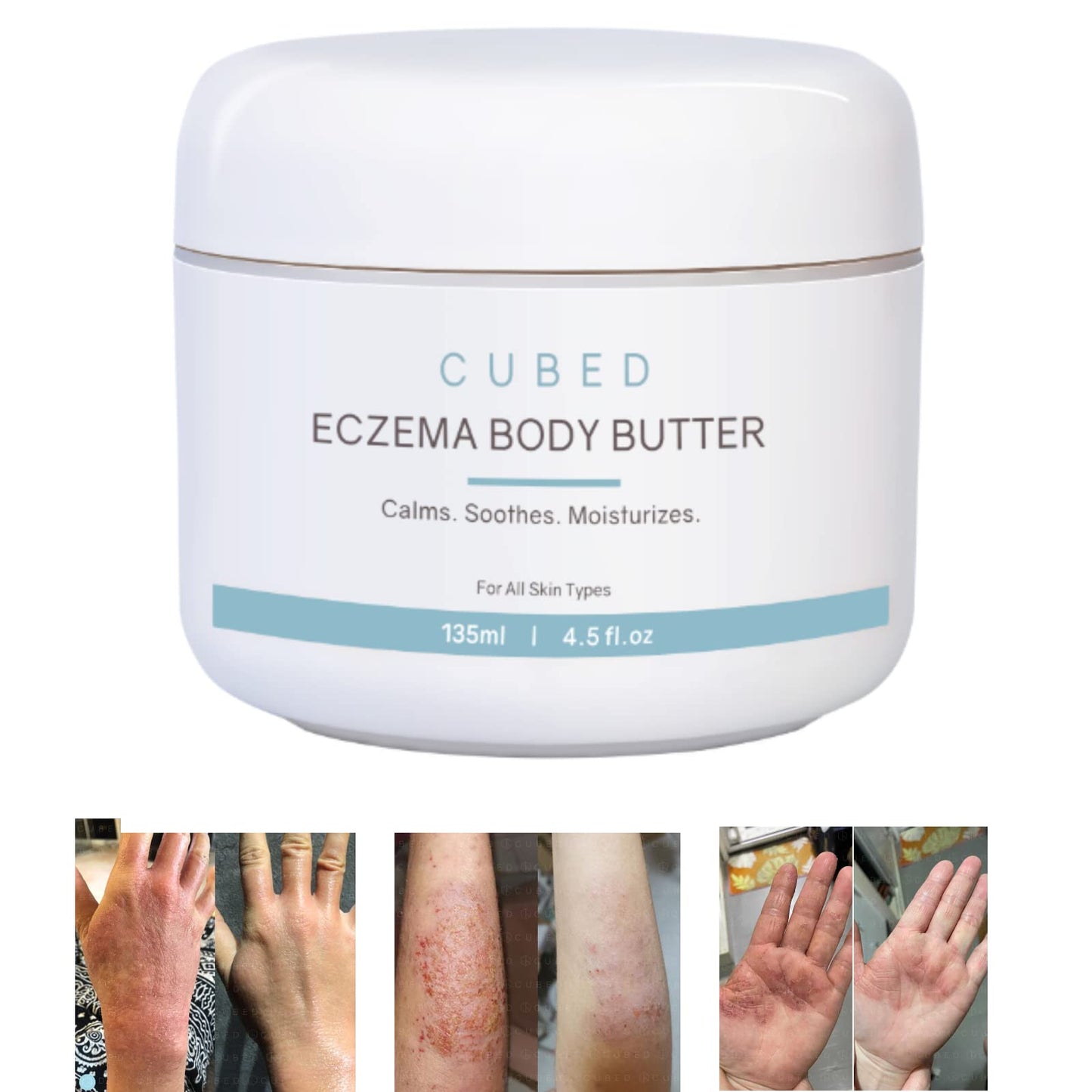 Cubed 4.5 oz Eczema Cream for Adults Eczema Relief Eczema Treatment Moisturize Dry Irridated Skin Smart Lotion for Topical Steroid Withdrawal Symptoms Psoriasis & Rosacea Eczema Dermatitis