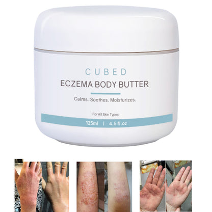 Cubed 4.5 oz Eczema Cream for Adults Eczema Relief Eczema Treatment Moisturize Dry Irridated Skin Smart Lotion for Topical Steroid Withdrawal Symptoms Psoriasis & Rosacea Eczema Dermatitis